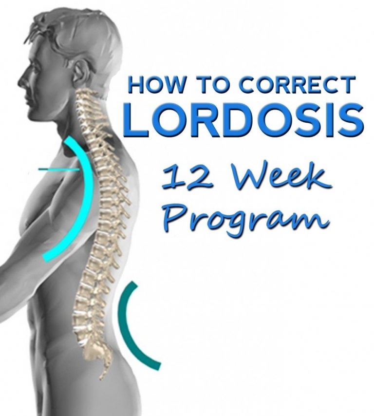 Understanding Cervical Lordosis Diagnosis Treatment And Improvements Becker Spine