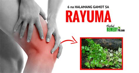 Rayuma o Arthritis