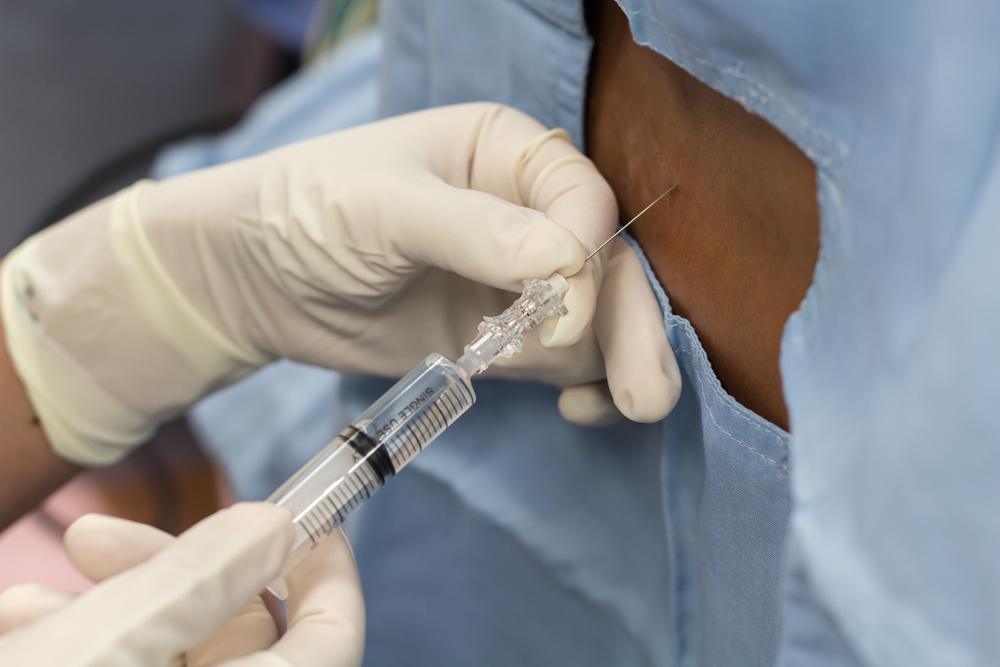 What Can You Expect from Spinal Epidural Injections for Pain Relief?