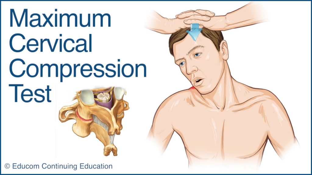Cervical Decompression Surgery illustration
