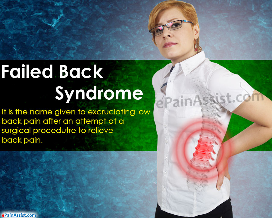 Illustration of Failed Back Syndrome