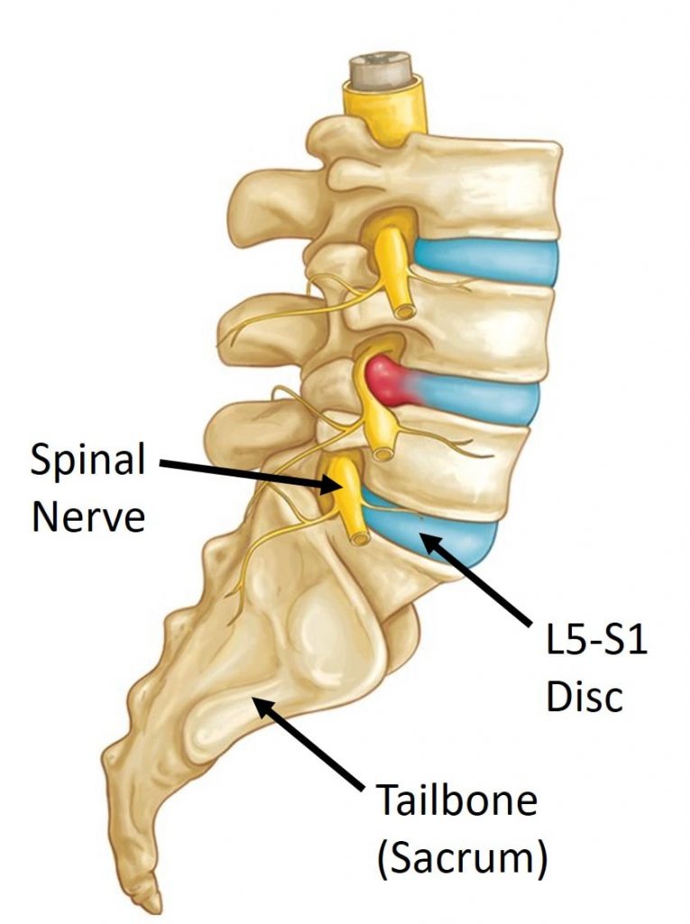 Lumbar Spinal Fusion Procedures