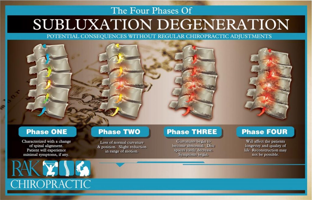 Exploring the Impact and Treatment of Vertebral Subluxation in Chiropractic Care