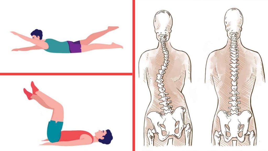 How Can the Schroth Method and Core Exercises Alleviate Scoliosis Symptoms?
