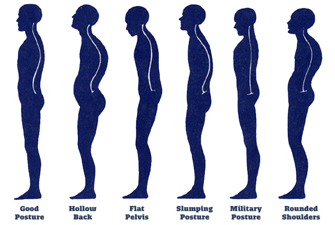 How Does Good Posture Benefit Your Health and Alleviate Back Pain?