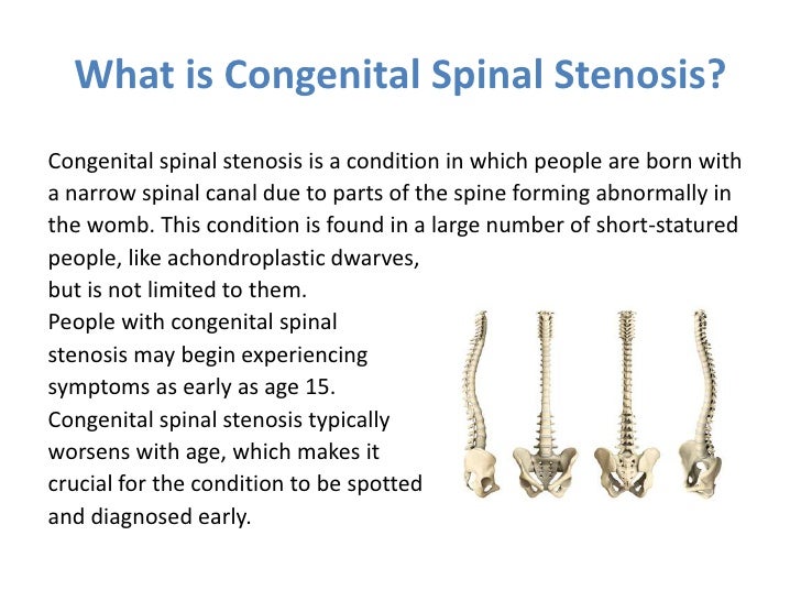 Understanding Congenital Spine Abnormalities and Their Impact on Health