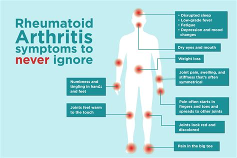Early Signs and Symptoms of Rheumatoid Arthritis