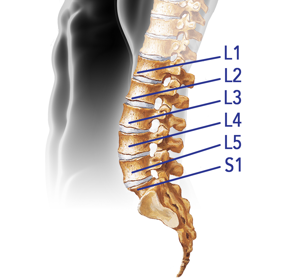 Understanding Spinal Conditions: From Lumbar Spondylosis to TLIF Surgery
