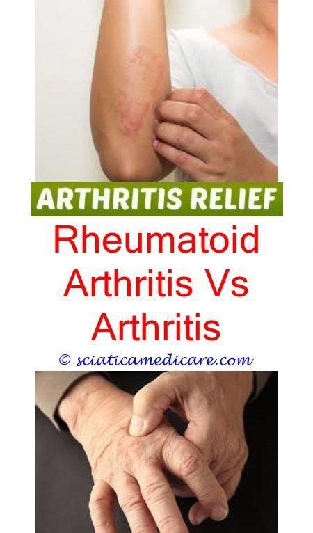 Understanding the Differences Between Arthritis and Rheumatism