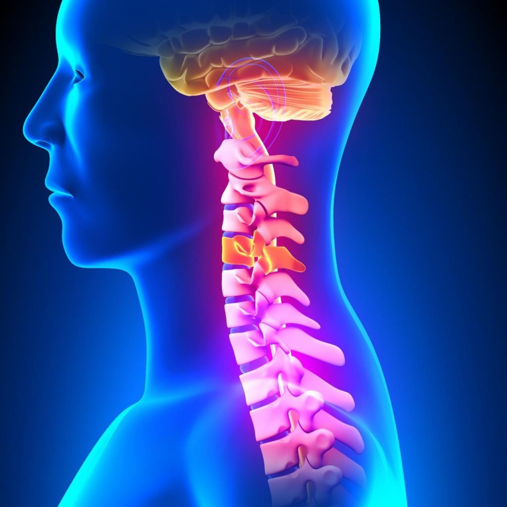 Cervical Spine Health and Anterolisthesis