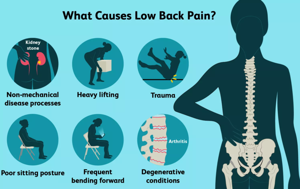 When Should You Seek Help for Low Back Pain?