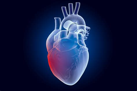 How Does Rheumatoid Arthritis Increase the Risk of Heart Disease?