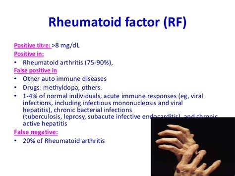 Understanding Positive Rheumatoid Factor