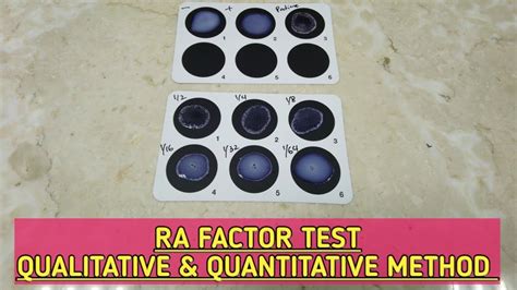 Understanding Positive Rheumatoid Factor Test Results
