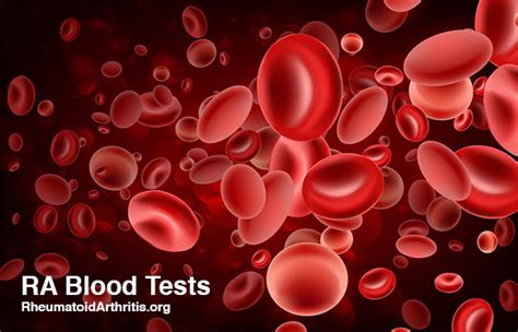 Understanding Rheumatoid Arthritis Blood Tests: Diagnosis and Monitoring
