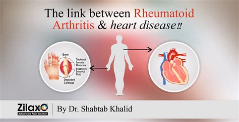 Understanding the Link Between Rheumatoid Arthritis and Heart Disease