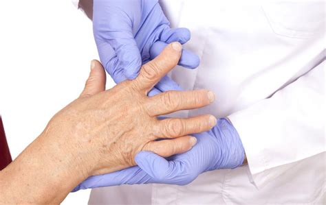 Can You Continue Working with Rheumatoid Arthritis?