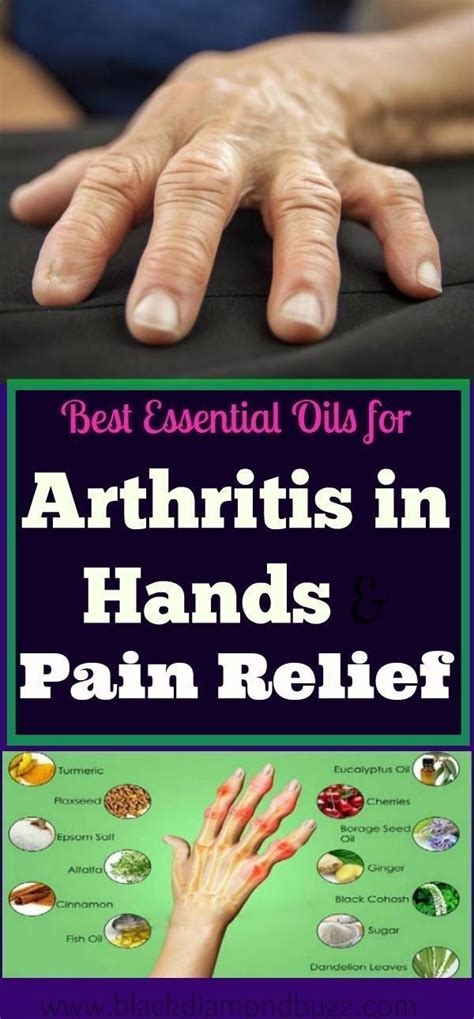 Effective Hand Therapies for Managing Rheumatoid Arthritis Pain