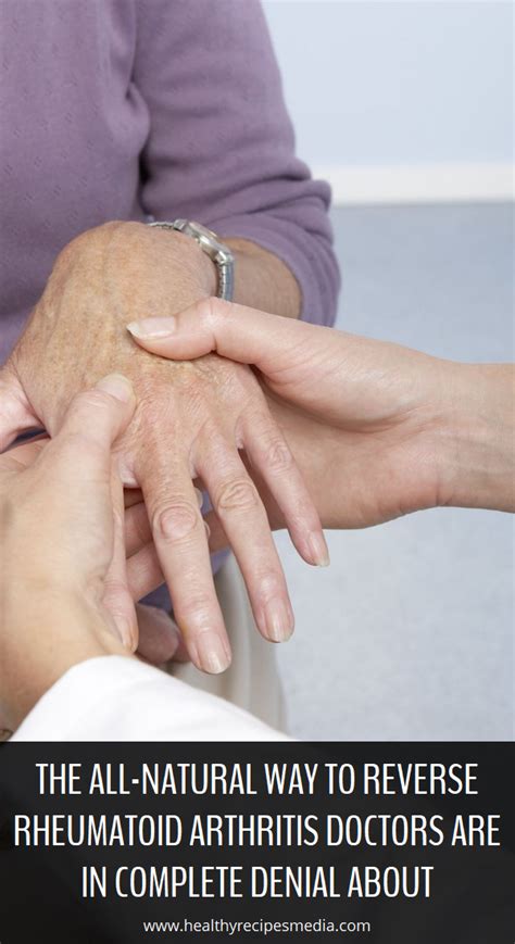 How to Find a Rheumatologist for Arthritis Treatment