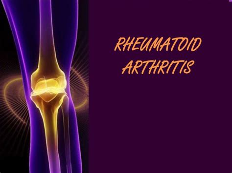 Understanding Rheumatoid Arthritis: A Comprehensive Overview