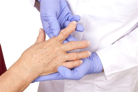 Understanding Rheumatoid Arthritis: Causes, Symptoms, and Treatment Options