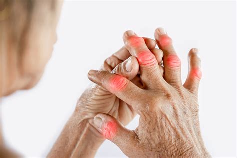 Understanding Rheumatoid Arthritis: Diagnosis and Treatment