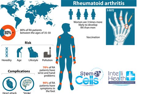 Understanding Rheumatoid Arthritis: Diagnosis, Treatment, and Care