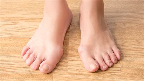 Understanding Rheumatoid Arthritis in Feet: Symptoms and Treatment Options