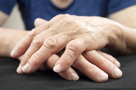 Understanding Rheumatoid Arthritis in Young Adults