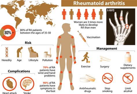 Understanding the Link Between Rheumatoid Arthritis and Heart Disease