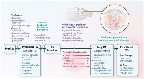 Understanding the Role of Immunosuppressants in Rheumatoid Arthritis Treatment