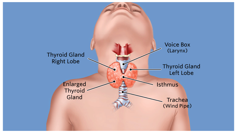 Thyroid Disease: Symptoms, Treatment, and Neck Pain Concerns